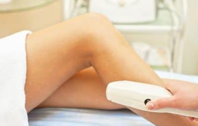 epilation-laser-definitive-methodes